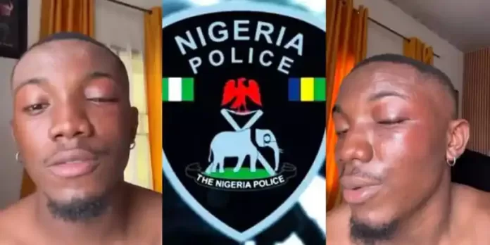 Man cries out after Owerri police drag him to bush in illegal search, extort ₦30,000